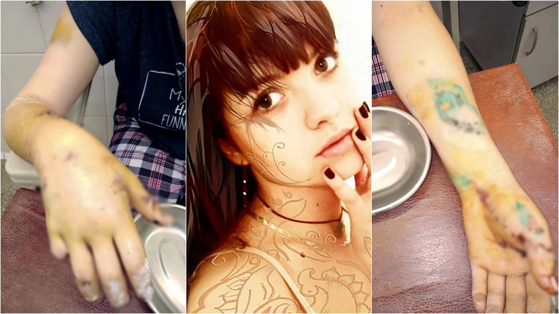 Burri gjymton me sëpatë ish-gruan, i pret gishtat (FOTO)