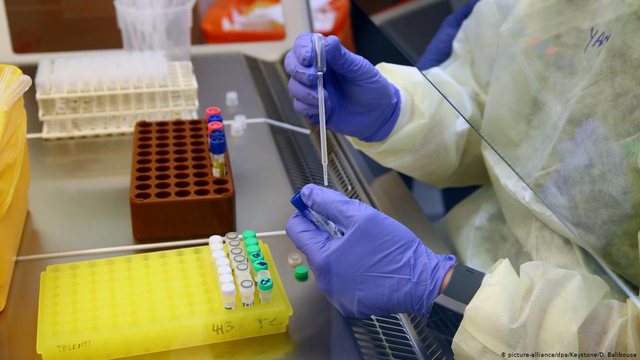 Testet e shpejta, mjekja: Nga data 20 dhjetor do bëhen në gjithë Tiranën