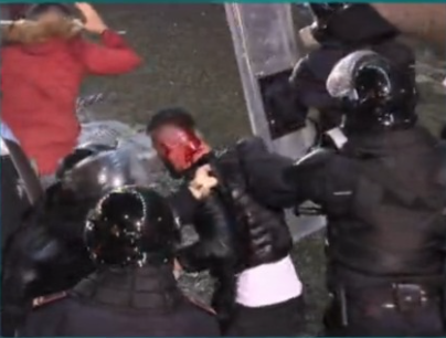 Efektivët e FNSH-së nuk lëshojnë të riun që e dhunuan dhe e gjakosën