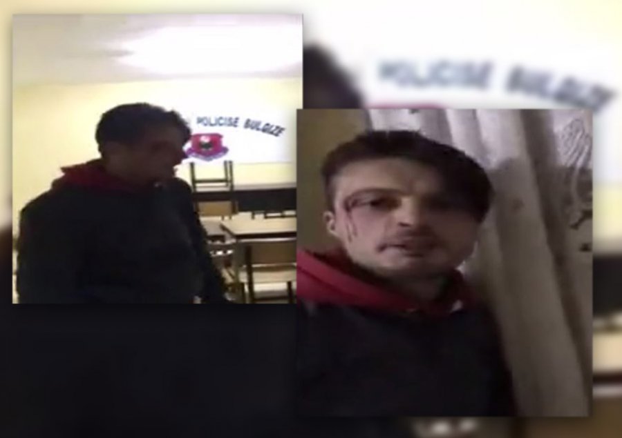 Dhunimi i të riut në komisariat, reagon policia