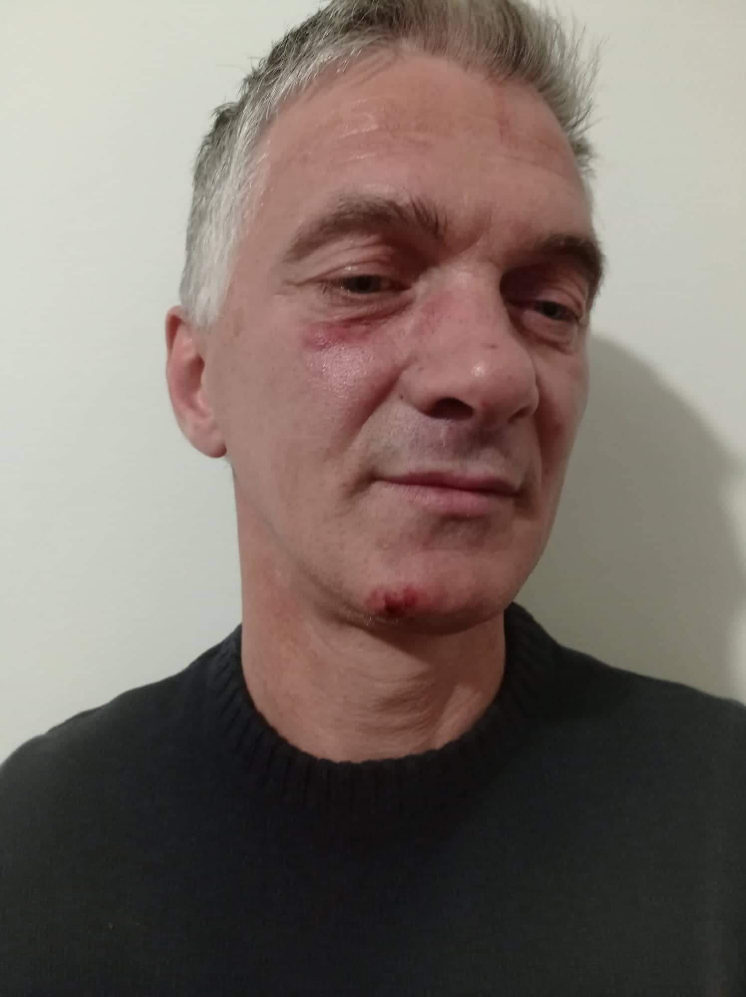 U ndalua dje nga policia, pedagogu Martini: Më gjuajtën me shkelm në komisariat, rajonin policor do e hedh në gjyq