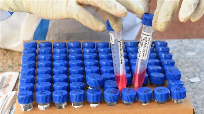 Kroaci, 3 918 raste infektimi dhe 85 të vdekur nga COVID-19