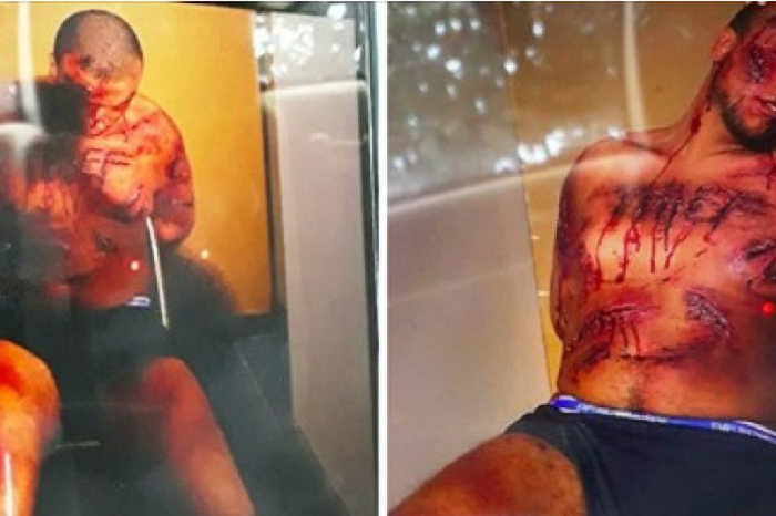 Tentoi t’i shpëtonte bandave shqiptare/ Kapet trafikanti që sajoi vdekjen me fotot e torturave