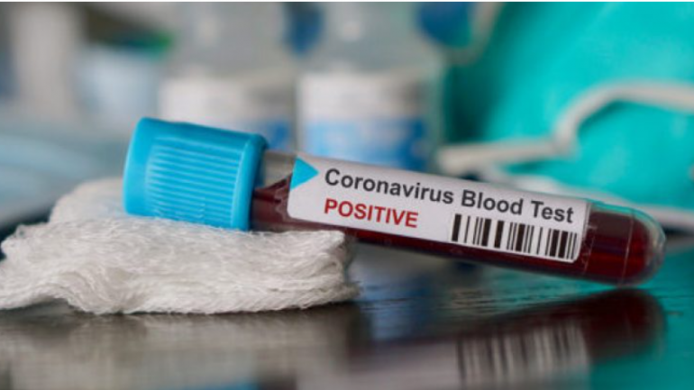 Maqedoni e Veriut, 14 viktima dhe 307 raste të reja me COVID-19