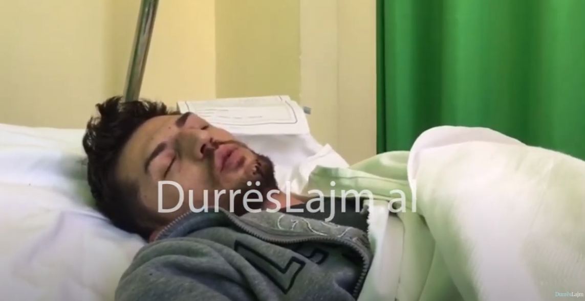 Arrestohet 32-vjeçari i shtruar në spitalin e Durrësit, akuzohet për dhunë fizike ndaj ish-gruas