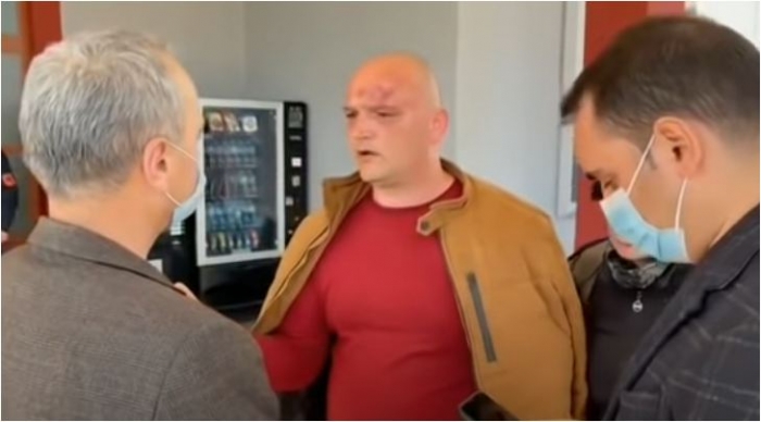 Dhunuan një person, shpallen në kërkim 3 vëllezërit