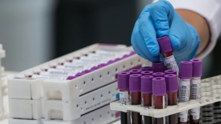 Kosovë, nis trajtimi i pacientëve të prekur nga Covid me plazmën e gjakut