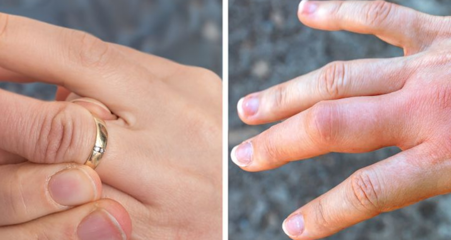 Kjo është arsyeja pse duhet t’i hiqni gjithmonë bizhuteritë, para se të flini