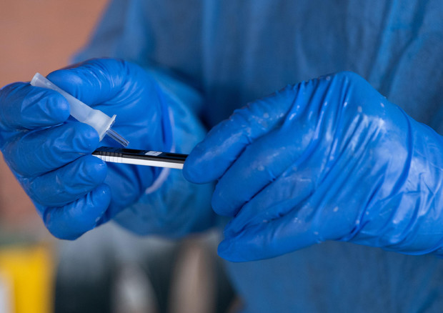 Itali, mbi 7 mijë të infektuar dhe 307 viktima nga COVID-19