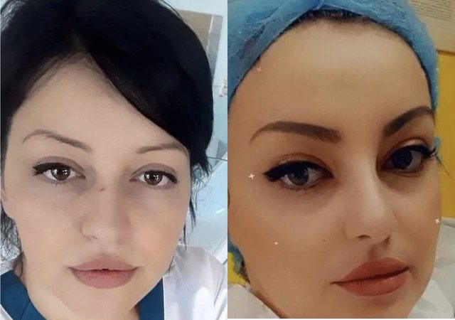 Kjo është një nga infermieret që u arrestuan, bashkëpunonte me Tiren për të ndarë paratë