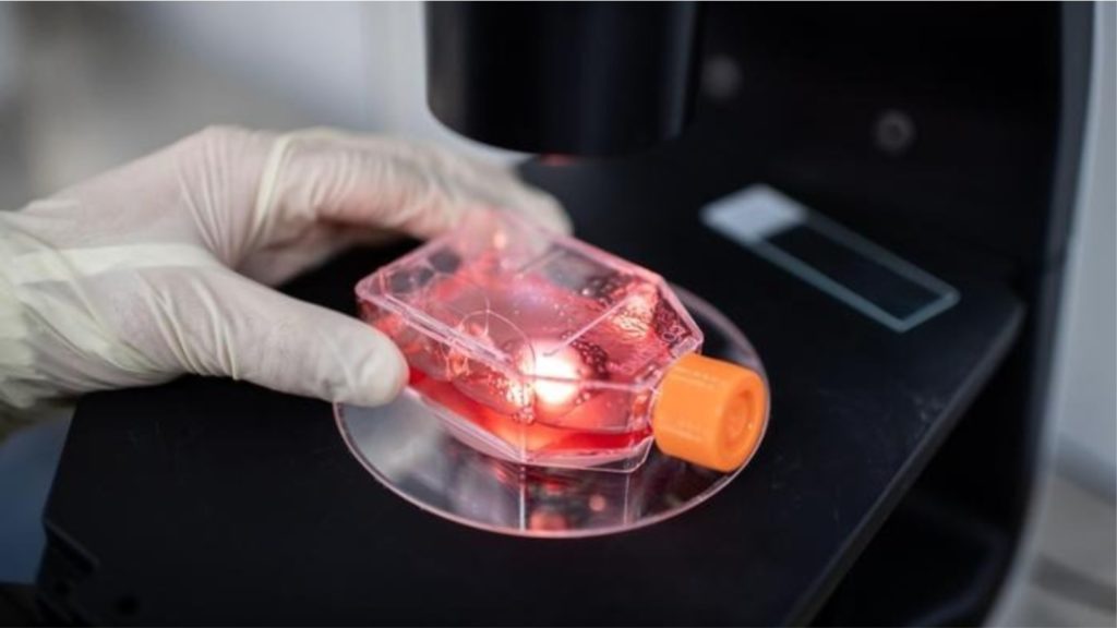 Zbulohet në Itali një variant i rrallë i koronavirusit