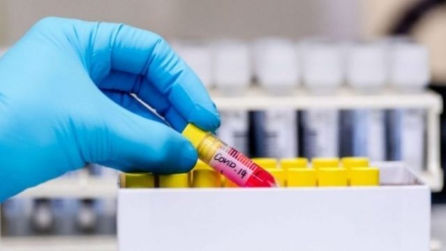 Maqedoni e Veriut, 30 viktima dhe 457 raste të reja me Covid-19