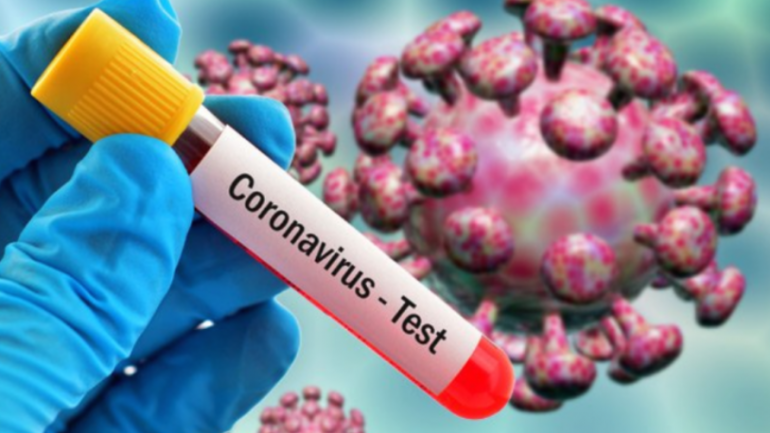 COVID-19 në Maqedoninë e Veriut, 24 viktima dhe 999 raste të reja