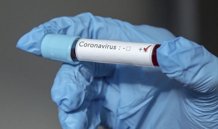 Kosovë, rritet ndjeshëm numri i rasteve të reja, 8 viktima