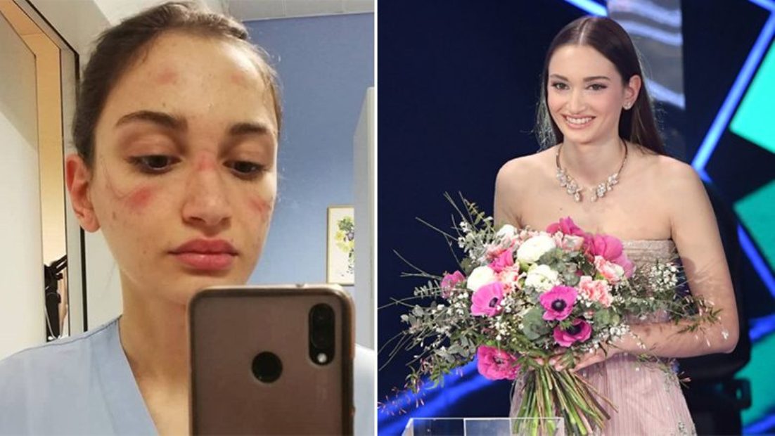 U bë virale gjatë pandemisë, infermierja ngjitet në skenën e Sanremos