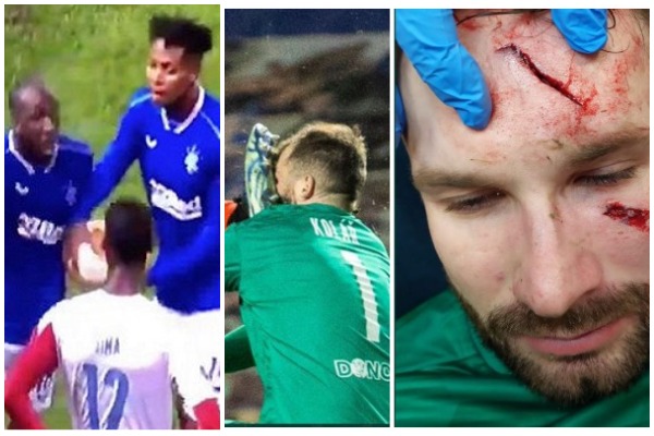 Takë në fytyrë dhe grushte në dhomat e zhveshjes, ndeshja e Ligës së Europës shndërrohet në luftë