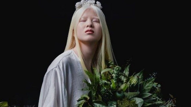 Modelja më e re albine po thyen rekorde në “Vogue”