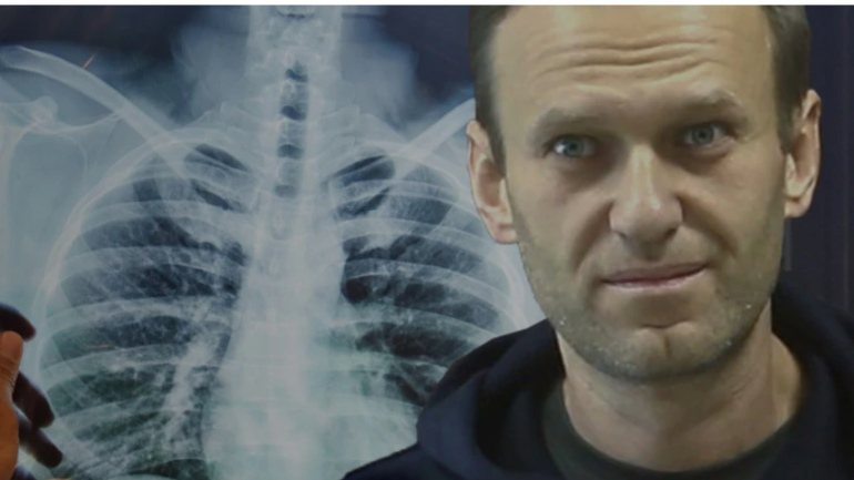 Navalny nga burgu: Më kërcënuan se do të më ushqejnë me forcë