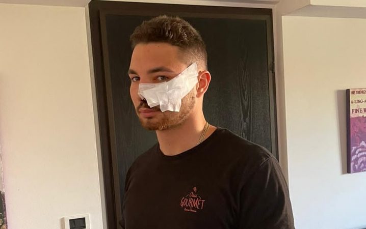 Itali, 16-vjeçari shqiptar godet me thikë 21-vjeçarin italian