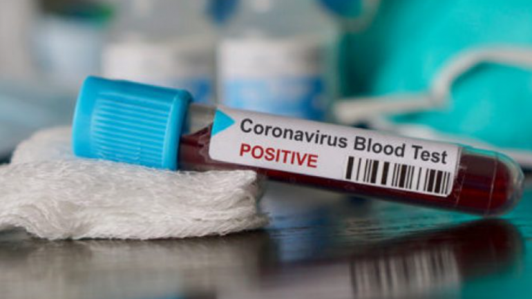 16 viktima dhe 50 raste me COVID-19 në Maqedoninë e Veriut