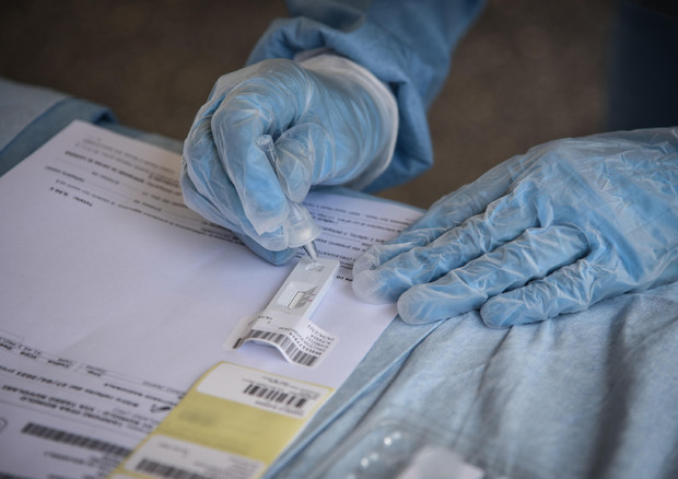 Itali, humbin jetën 182 qytetarë, 7,567 raste të reja me Covid-19