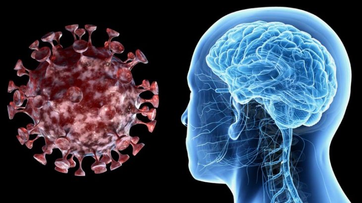 Neurologia Basha: Covid-19 shkakton infarkt në tru