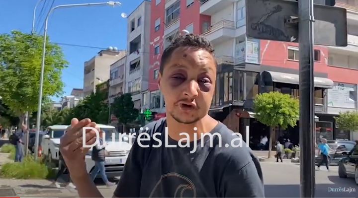 I zbathur dhe i mavijosur, marokeni në Durrës rrëfen dhunën barbare: Më rrahën në polici, kam ndenjur 7 ditë pa ngrënë (VIDEO)