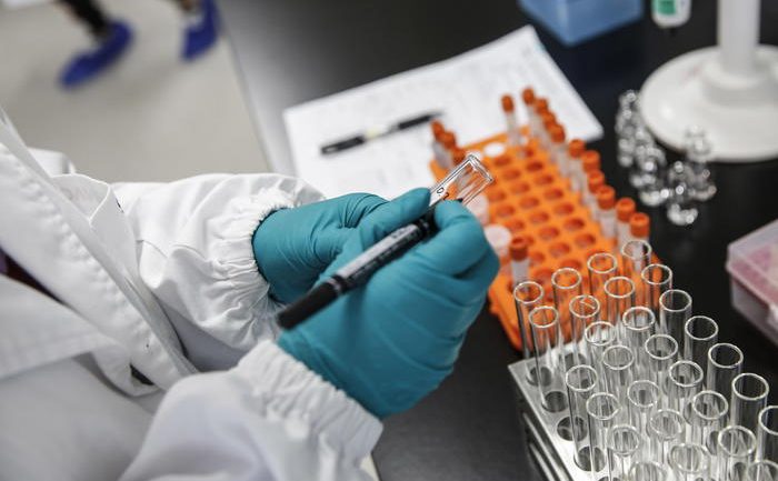 Ekspertët: Së shpejti varianti Delta i Covid-19 dominues në SHBA