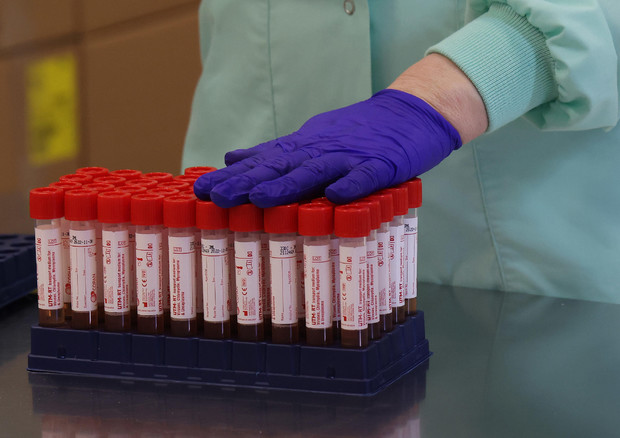 Itali, rritet numri i infektimeve, regjistrohen 77 viktima gjatë 24 orëve të fundit