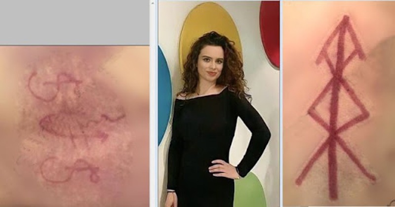 Studiuesi shpjegon shenjat në trupin e Evgjeni Baxhos: Është magji!