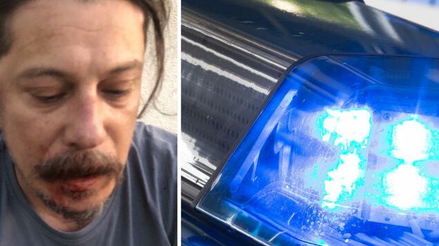 Kritik i Erdoganit, gazetari turk sulmohet jashtë shtëpisë së tij