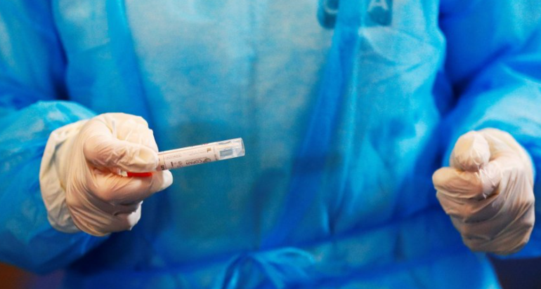 Maqedoni e Veriut/ 1 viktimë dhe 17 raste të reja me COVID-19