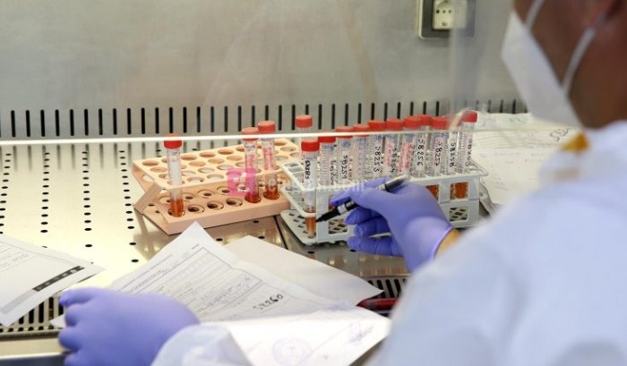 Asnjë vdekje dhe 12 raste të reja me COVID-19 në Kosovë