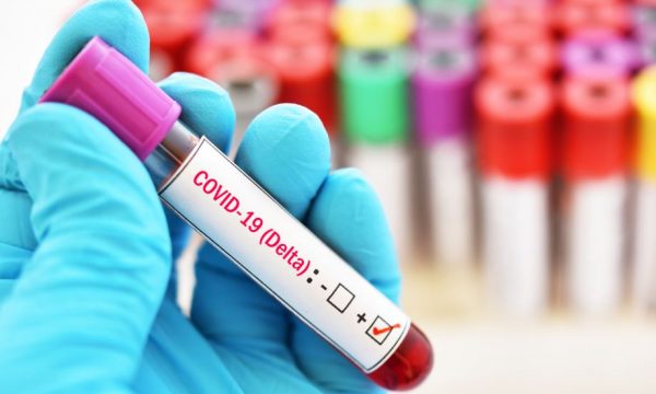 Varianti Delta përhapet frikshëm në Greqi