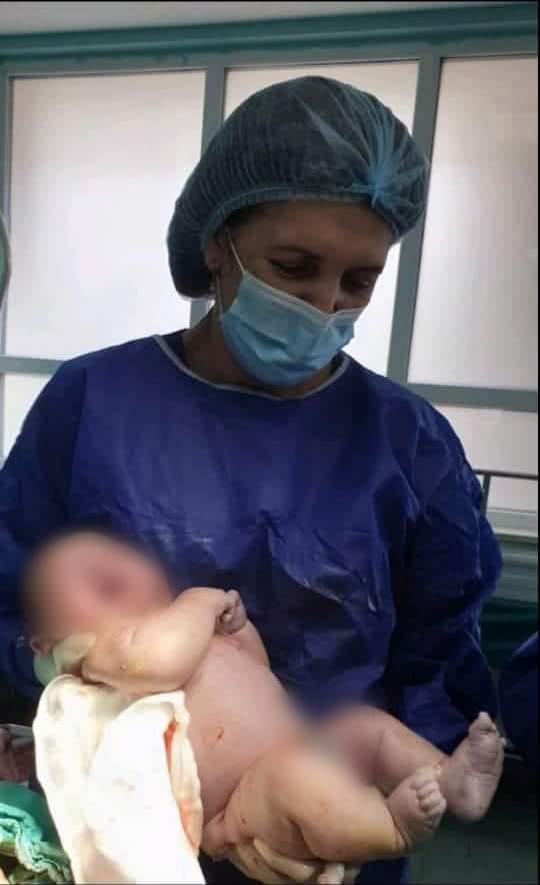 Vjen në jetë bebja me peshë 6.5 kg