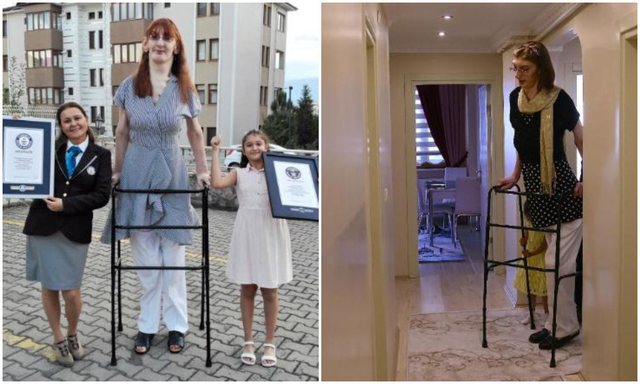 Njihuni me femrën më të gjatë në botë, mbi 2 metra
