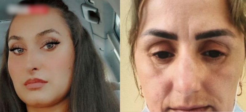 Vidhte kartat e identitetit të pacientëve dhe merrte kredi, Gjykata cakton masën e sigurisë për infermieren