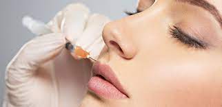 Qeveria angleze ndalon botox-in dhe rimodelimin e buzëve te personat nën 18 vjeç