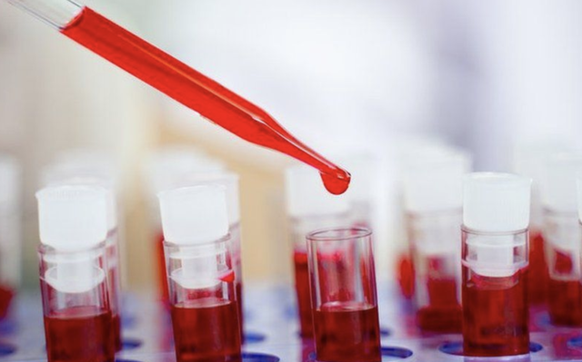 E rrallë/ Një grua është shëruar nga SIDA pa ilaçe ose trajtim