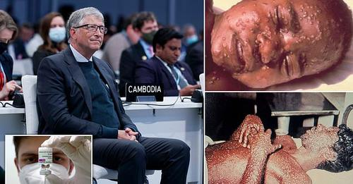 Bill Gates paralajmëron njerëzimin: Pandemia e lisë është “sulmi terrorist” i radhës