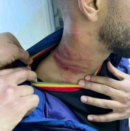 Pamje të rënda/ Ndërhyrja e rrezikshme e portierit, nuk mban përgjegjësi, por i kërkon llogari arbitrit