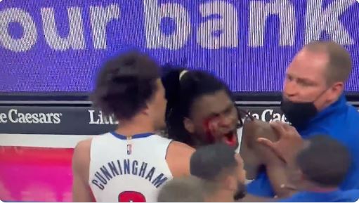 Sherr masiv në “NBA”, Lebron Xhejms gjakos kundërshtarin (VIDEO)