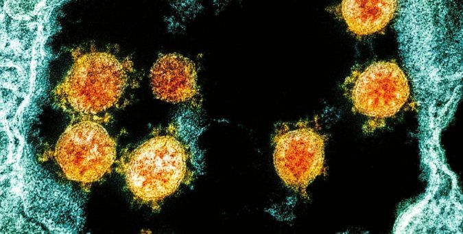 Zbulohet një variant i ri i Covid-19, shumë i ndryshëm nga të tjerët