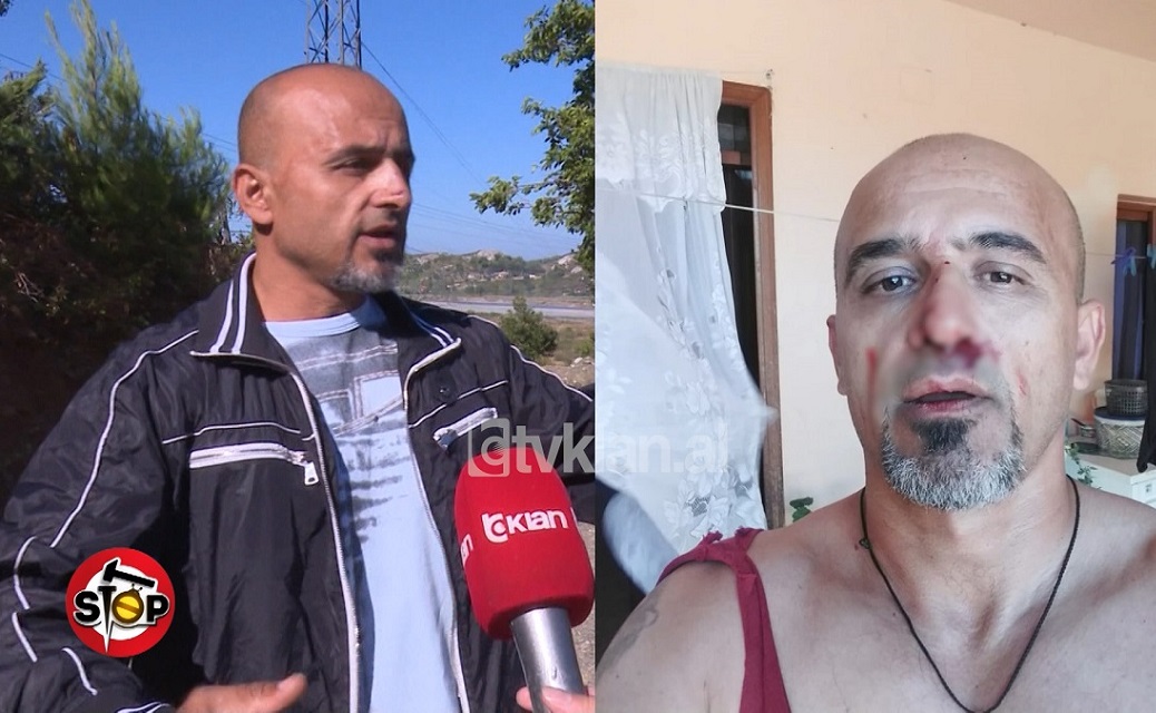 Sherr për rrugën/ Qytetari denoncon fqinjët: “Më qëlluan me grushte dhe shkelma”