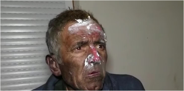 Iu dogj shtëpia dy-katëshe, pronari me plagë në fytyrë: “Të gjitha gjërat i përpiu zjarri!”