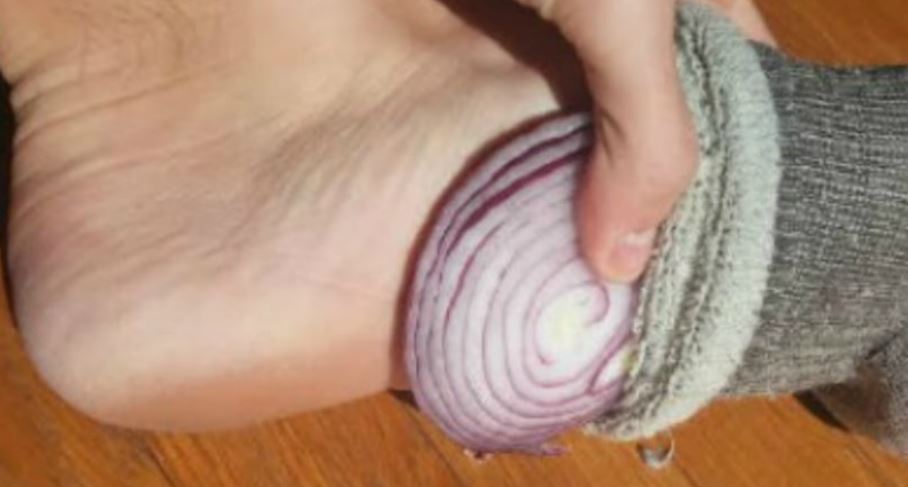 Çfarë ndodh kur vendosni qepë në çorape ndërsa flini