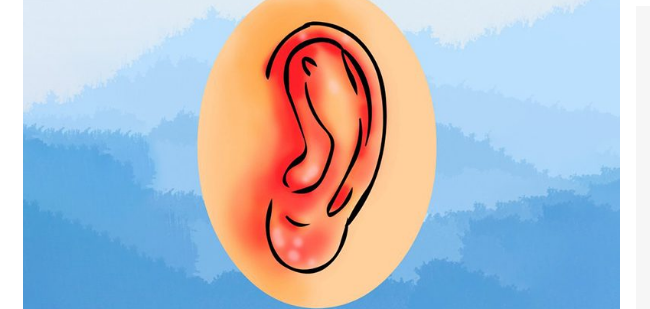 A ju skuqen papritur veshët dhe nxehen shumë? Ja për çfarë bëhet fjalë