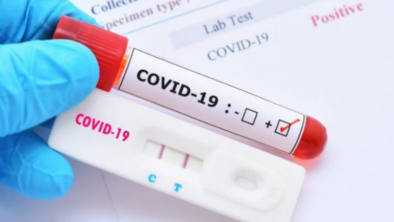 Maqedoni e Veriut/ 1,348 të infektuar dhe 8 humbje jete nga Covid-19