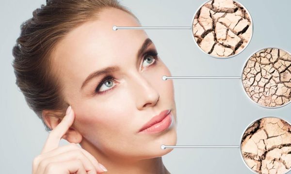 Keni lëkurë të dehidratuar? Maska e thjeshtë me 3 përbërës për super rezultate