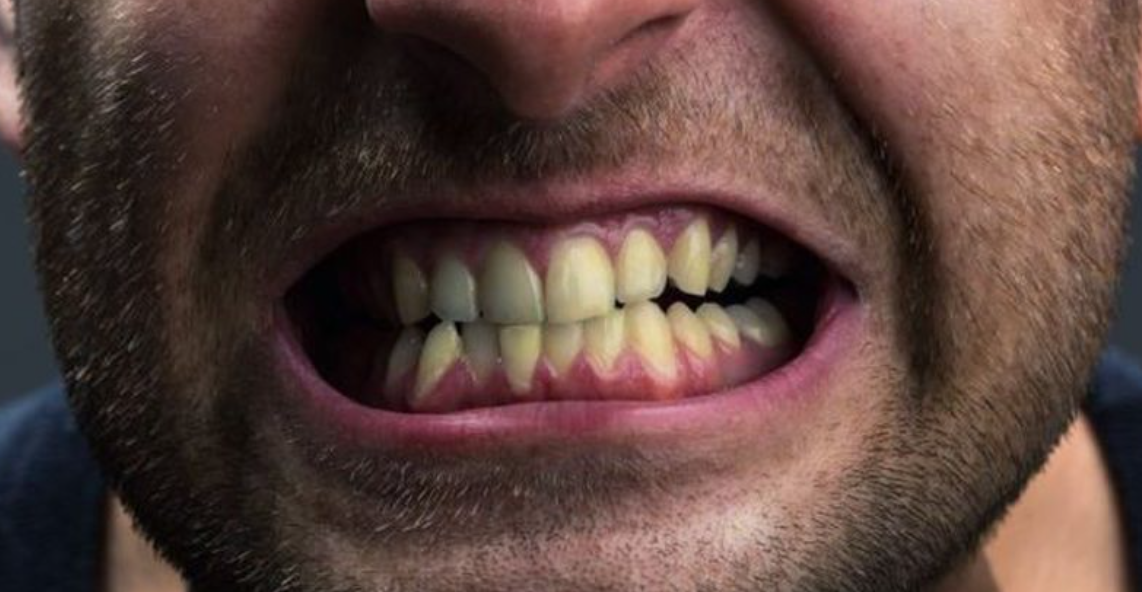 Hiqni dorë nga këto zakone të përditshme, po ju dëmtojnë dhe zverdhin dhëmbët